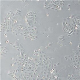 人前列腺增生細胞BPH-1  (STR鑒定正確)