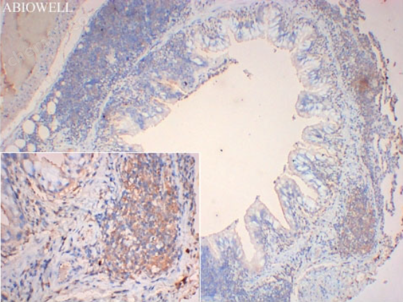 image.png 艾碧維KiSS-1R兔多克隆抗體