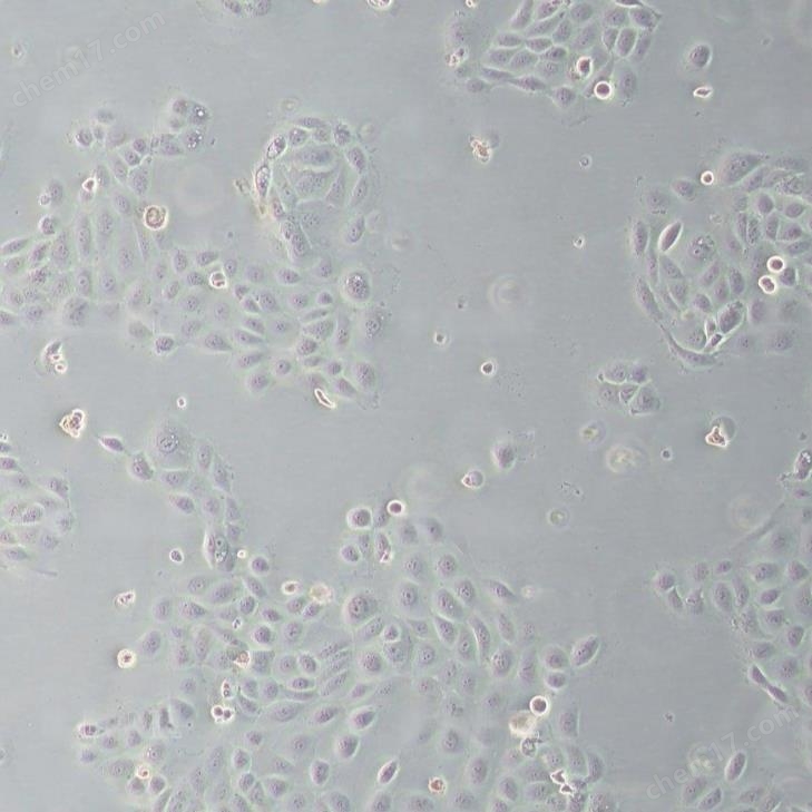 人前列腺增生細(xì)胞BPH-1  (STR鑒定正確)