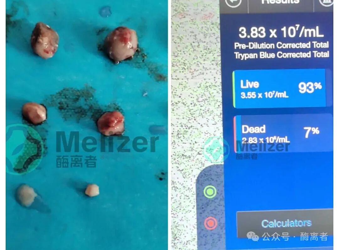 810a9cb28c745ba075ac914cc5525190.jpg 解離酶