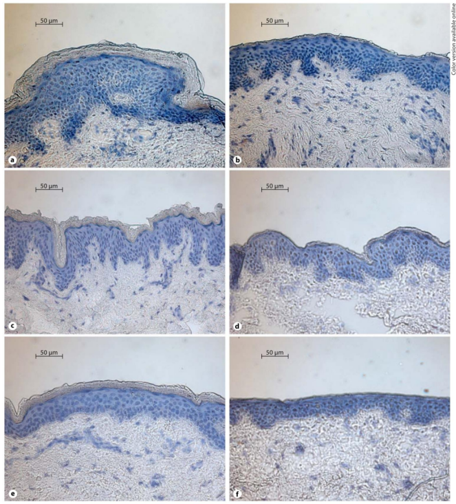 image.png 紅外光密度法:體外膠帶剝離實驗的角質深度標尺