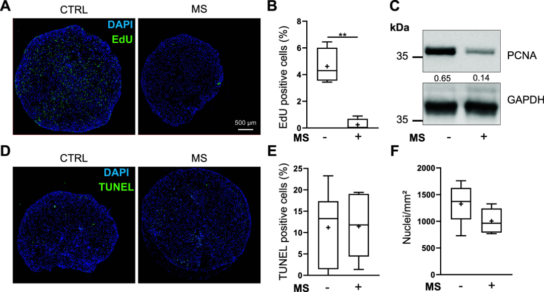 机械刺激马源骨髓间充质基质细胞体外软骨模型可触发骨关节炎特征