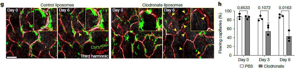 《Nature》:真皮巨噬細(xì)胞缺失促進(jìn)皮膚毛細(xì)血管衰老