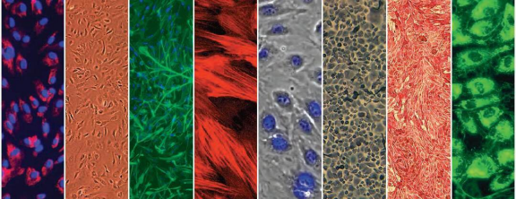 Lonza原代人肺成纖維細(xì)胞NHLF, Human Lung Fibroblasts產(chǎn)品介紹